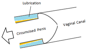 Coronal ridge forces lubrication out